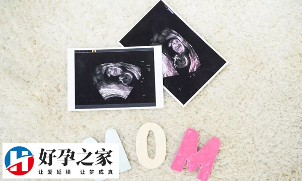 二维彩超排畸最佳时间