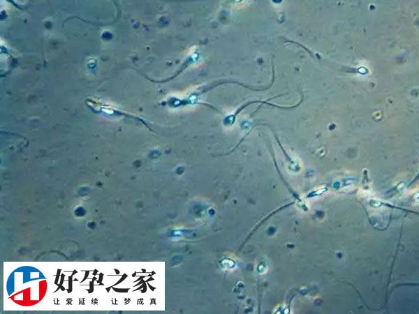 男性精子质量也会显著影响成功率