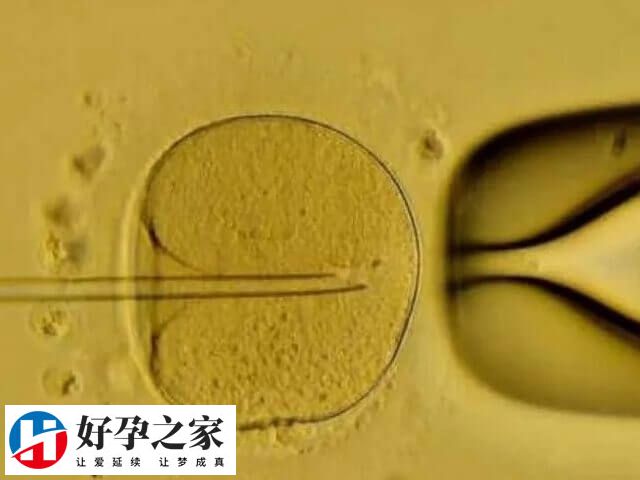 单囊胚移植的优势和劣势有哪些