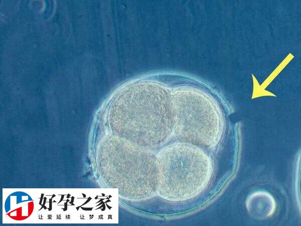 囊胚解冻移植流程及费用多少