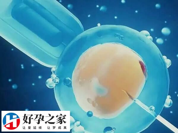 男性不育精子质量差能做第二代试管婴儿生育吗？
