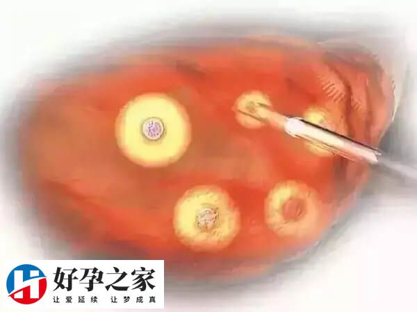 取卵后有血块流出是什么原因