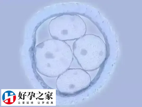 促排怀双胞胎减胎后注意卧床休息