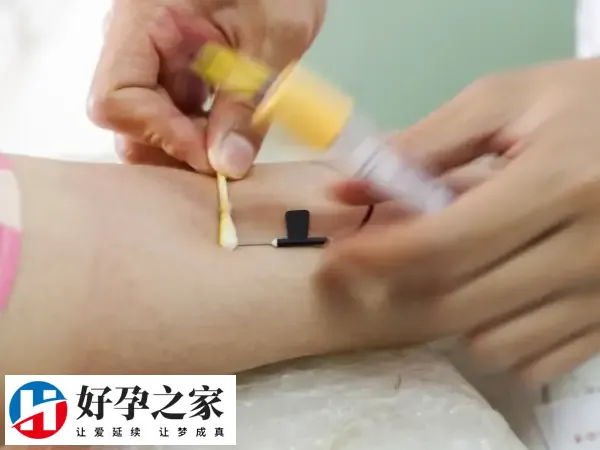 移植前做抽血检查是必须的